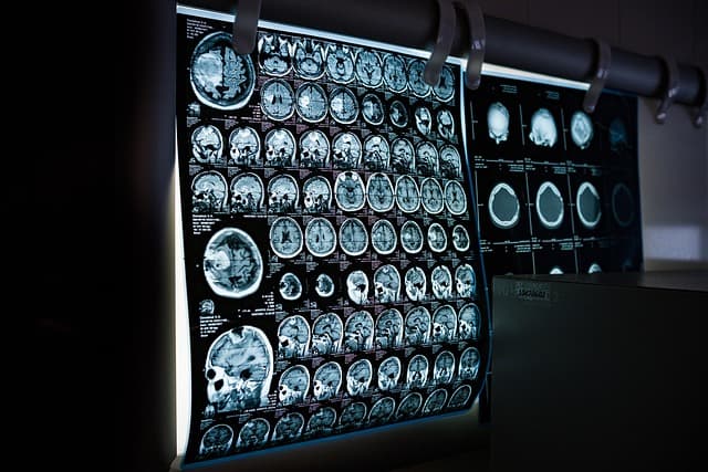 Les critères essentiels pour choisir des fournitures médicales